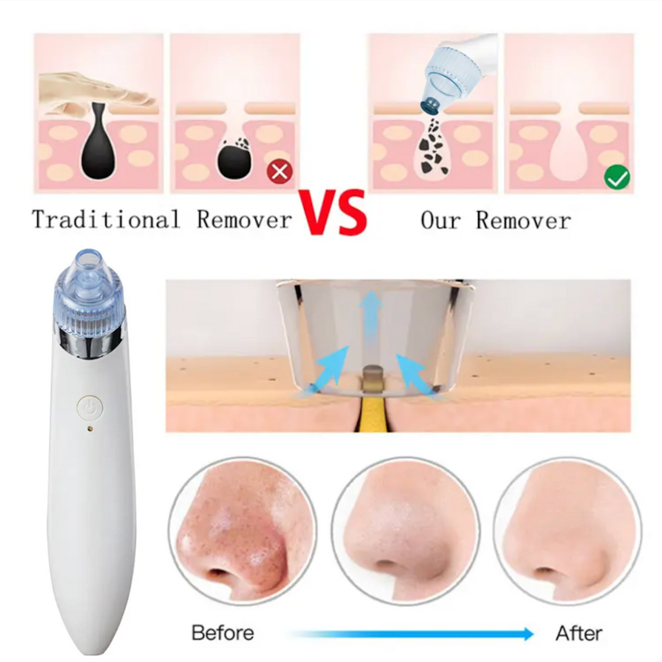 Beauty Pore Vacuum